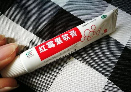 鳳仙花竟可以除菌？皮膚科專家揭秘 45天擺脫“丑指甲”的個人衛(wèi)生指南